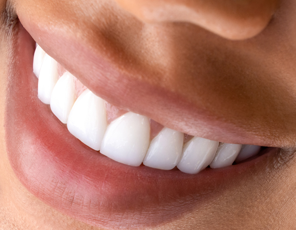 Whitening