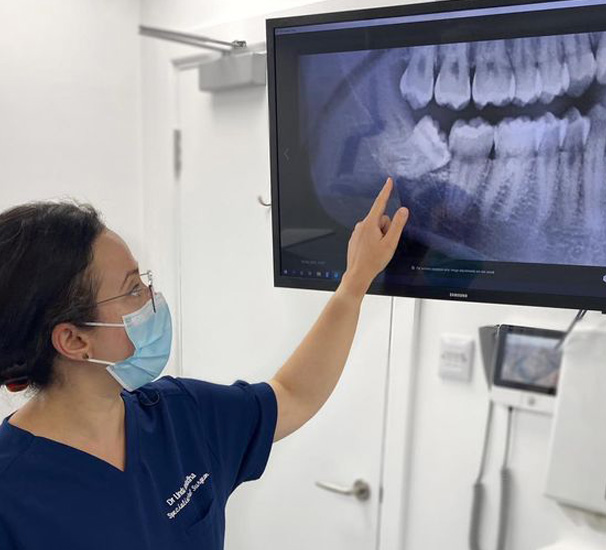 Wisdom teeth removal