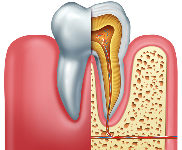 root canal treatment
