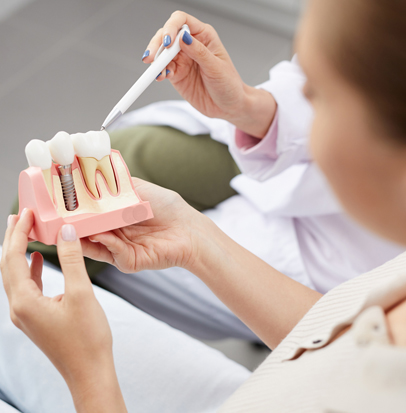 Dental Implants