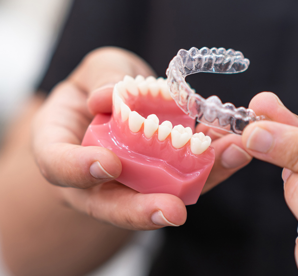 Key benefits of aligners
