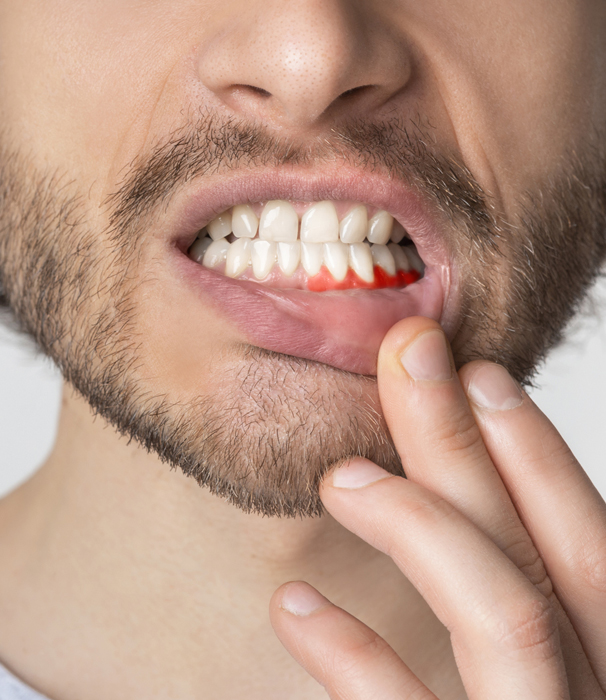 What are the signs, risks and causes of gum disease?